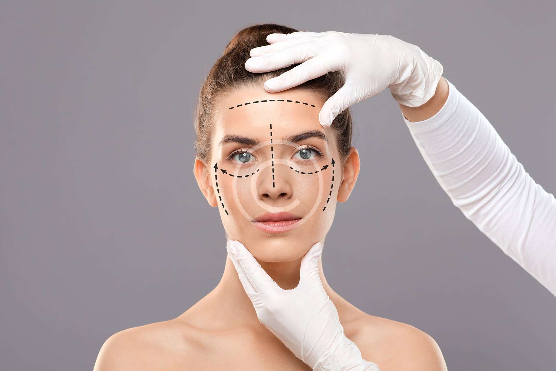 Lifting cervico-facial