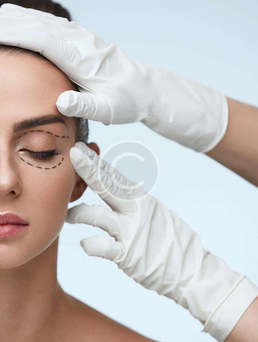 Blepharoplastie