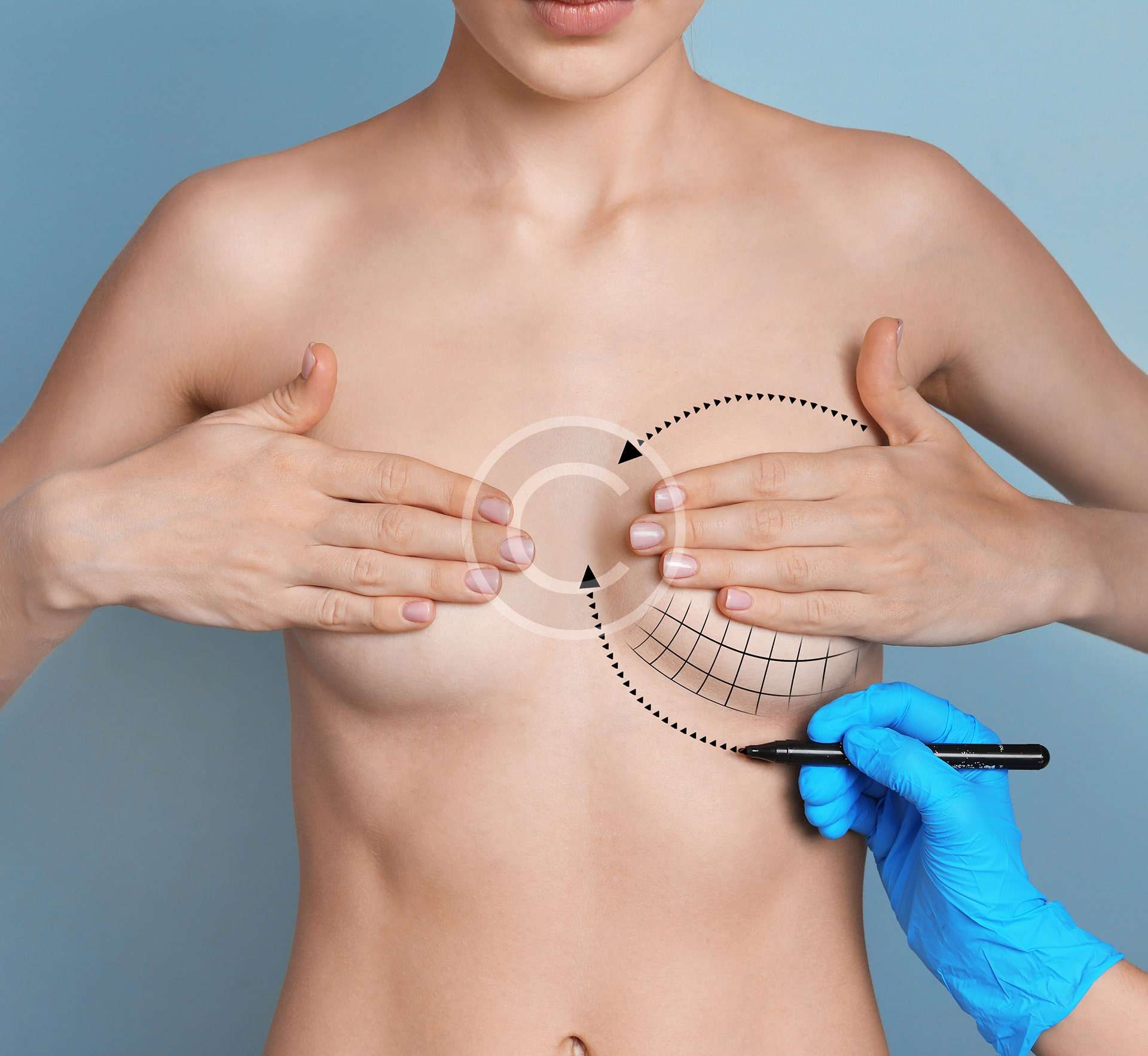 Augmentation mammaire