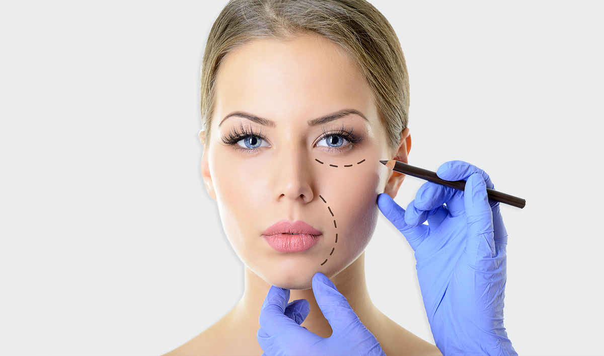 Lifting cervico-facial