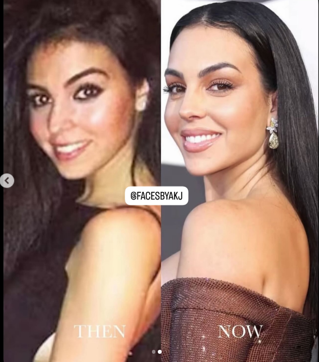 Georgina Rodriguez-visage en avant et après