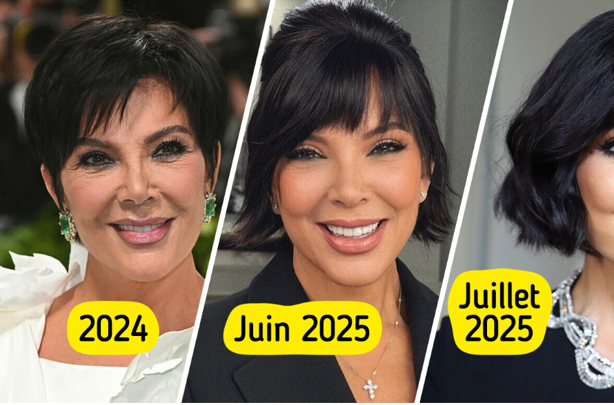 Avant et après du visage de Kris Jenner après son lifting