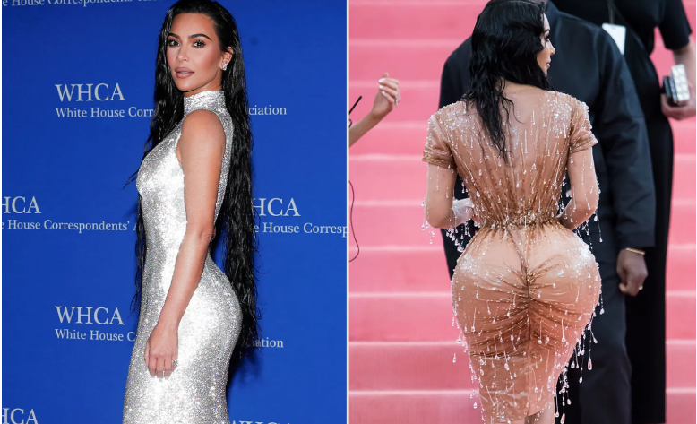 avant et après de la bbl de Kim Kardashian