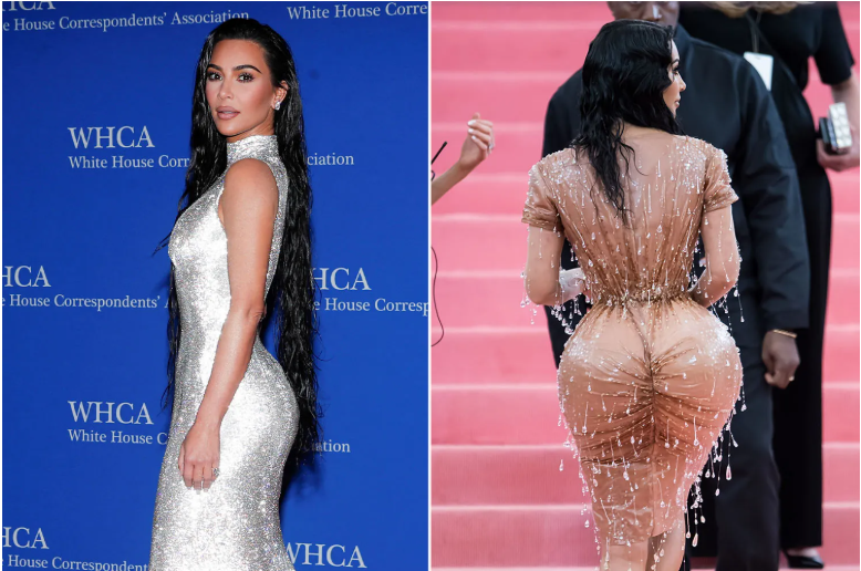 avant et après de la bbl de Kim Kardashian