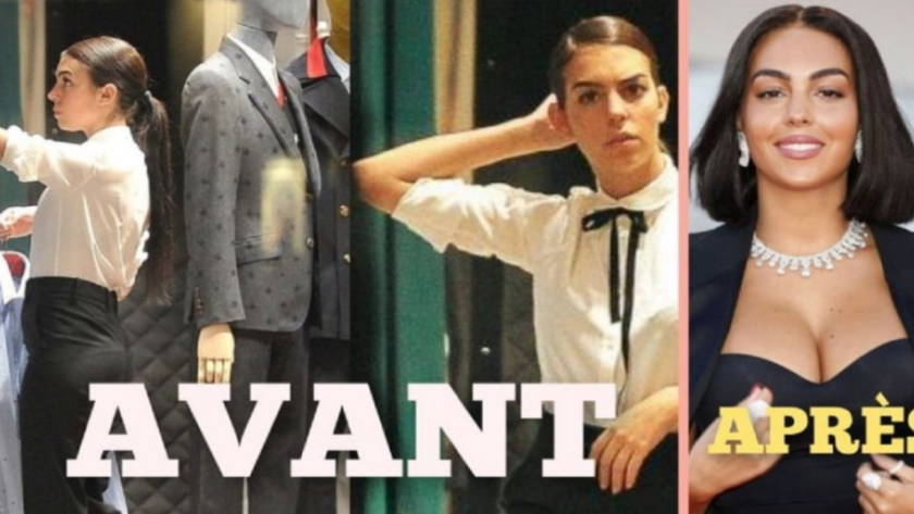 georgina rodriguez avant après chirurgie esthétique