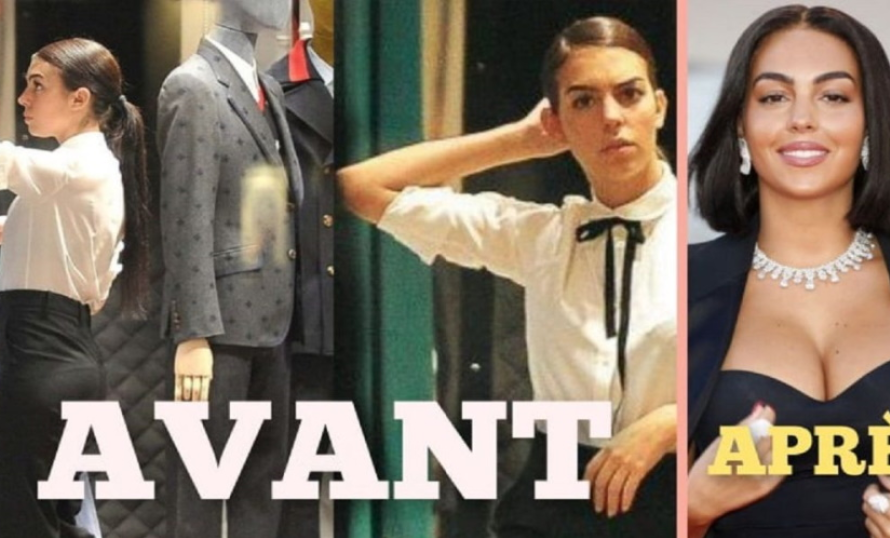 georgina rodriguez avant après chirurgie esthétique