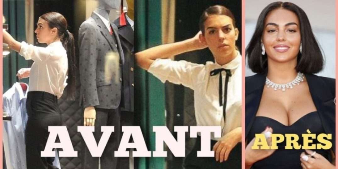 georgina rodriguez avant après chirurgie esthétique