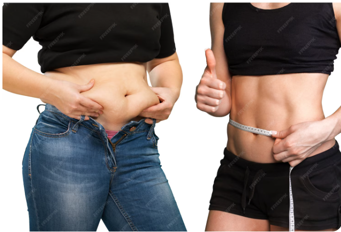 le sleeve gastrique avant et après